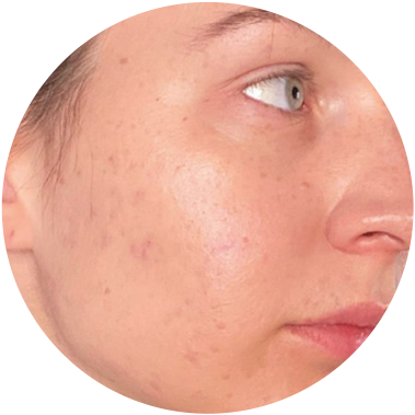 Pleť po použití CICA EXO Solution Ampoule