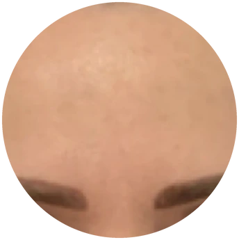 Pleť po používání CICA EXO krému, ukázka 2