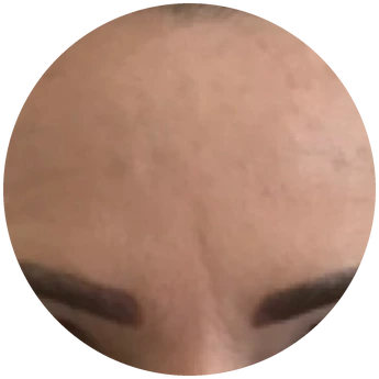Pleť před používáním CICA EXO krému, ukázka 2