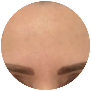 Pleť po použití CICA EXO tonika, ukázka 2