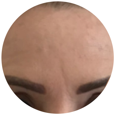 Pleť před použitím CICA EXO tonika, ukázka 2