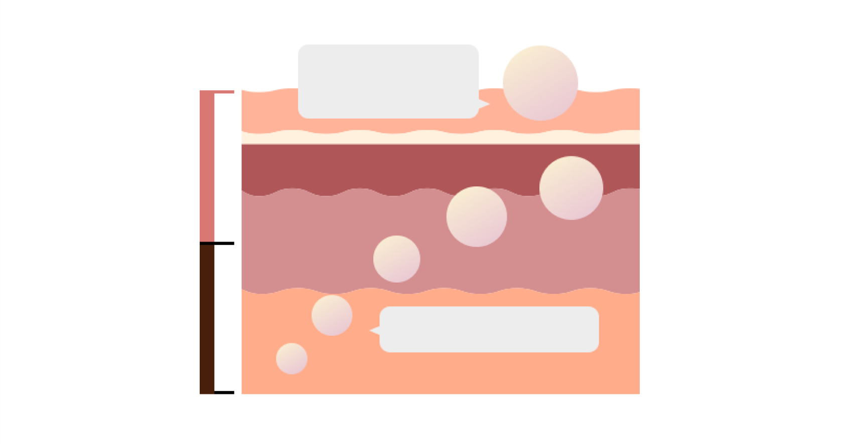 Diagram kožních vrstev