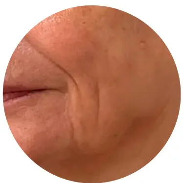 Pleť po použití — zákaznice 1