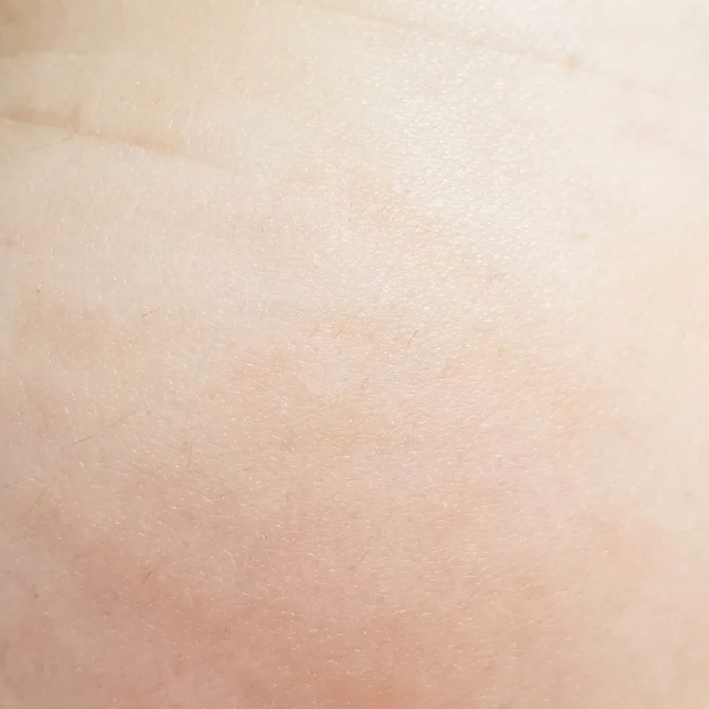 Detail hladké pokožky po použití očního krému